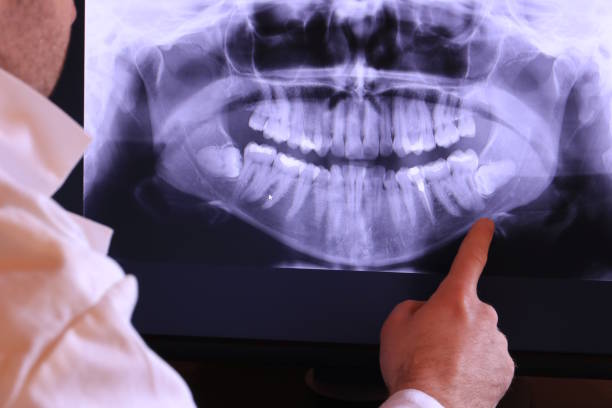 Best Emergency Tooth Extraction in Lone Grove, OK