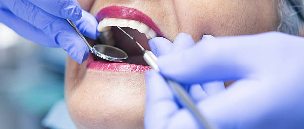 Best Emergency Treatment for Dental Infections or Abscesses in Lone Grove, OK